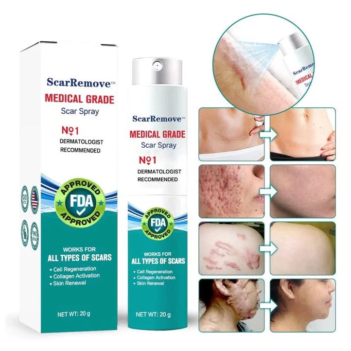 ScarRemove™ All Type Scar Removal Spray - Korean Made | BUY 1 GET 1 FREE | ⭐️⭐️⭐️⭐️ 4.9/5 Reviews
