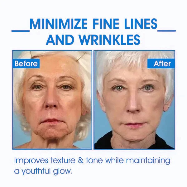 Fubsta™ Advanced Skin Tightening Rejuvenating Cream ( BUY 1 GET 1 FREE )⭐️⭐️⭐️⭐️ 4.9/5 Reviews