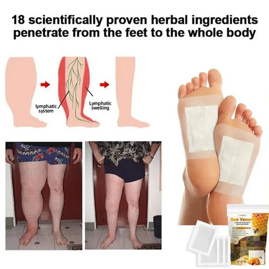 Bee Venom Lymphatic Drainage & Slimming Foot Patches 🌿👣10 Foot Patches!| BUY 1 GET 1 FREE | ⭐️⭐️⭐️⭐️ 4.9/5 Reviews