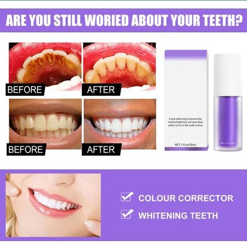 ๐ฅLAST DAY 55% OFF๐ฅTeeth Colour Corrector Serum