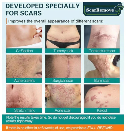ScarRemove™ All Type Scar Removal Spray - Korean Made | BUY 1 GET 1 FREE |  ⭐️⭐️⭐️⭐️ 4.9/5 Reviews