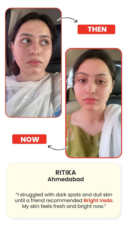 Support for Skin Clarity & Radiance Bright Veda