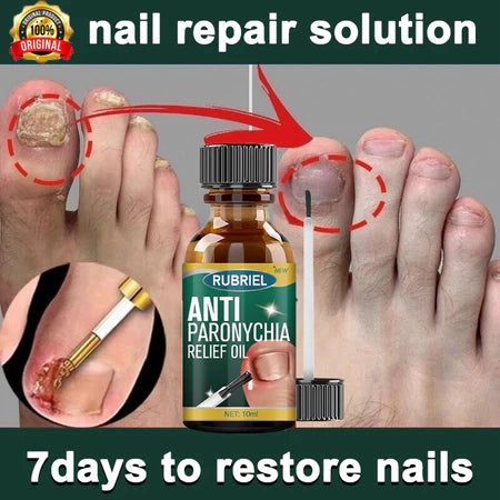 Anti Paronychia Relief Oil ( BUY 1 GET 1 FREE )