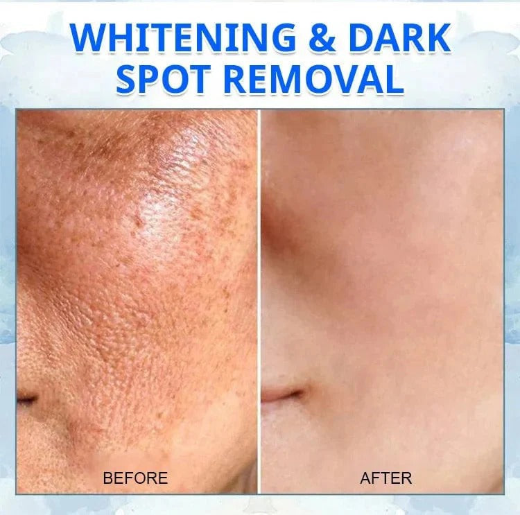 𝐅𝐮𝐛𝐬𝐭𝐚® 𝐀𝐝𝐯𝐚𝐧𝐜𝐞𝐝 𝐅𝐢𝐫𝐦𝐢𝐧𝐠 & 𝐖𝐫𝐢𝐧𝐤𝐥𝐞-𝐑𝐞𝐝𝐮𝐜𝐢𝐧𝐠 𝐂𝐫𝐞𝐚𝐦: Restore Skin Elasticity⭐ ( BUY 1 GET 1 FREE )
