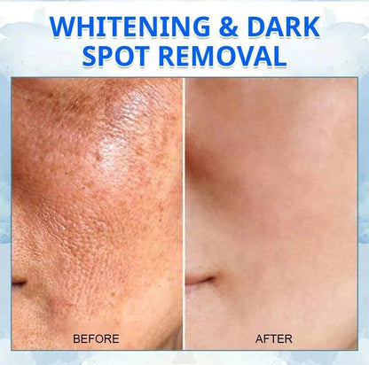 𝐅𝐮𝐛𝐬𝐭𝐚® 𝐀𝐝𝐯𝐚𝐧𝐜𝐞𝐝 𝐅𝐢𝐫𝐦𝐢𝐧𝐠 & 𝐖𝐫𝐢𝐧𝐤𝐥𝐞-𝐑𝐞𝐝𝐮𝐜𝐢𝐧𝐠 𝐂𝐫𝐞𝐚𝐦: Restore Skin Elasticity⭐ ( BUY 1 GET 1 FREE )