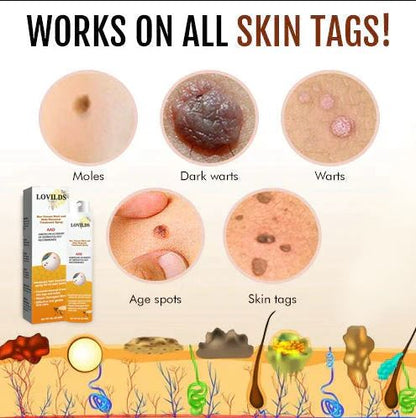 WartX™ Bee Venom Tags & Wart Treatment Spray | Buy 1 Get 1 Free