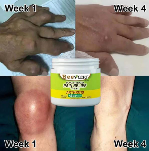 (Pack of 3) BeeTherapy™ #1 Bee Venom Pain Relief Cream | Buy 1 Get 2 Free | ⭐️⭐️⭐️⭐️ 4.9/5 Reviews