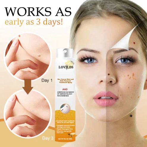 WartX™ Bee Venom Tags & Wart Treatment Spray | Buy 1 Get 1 Free